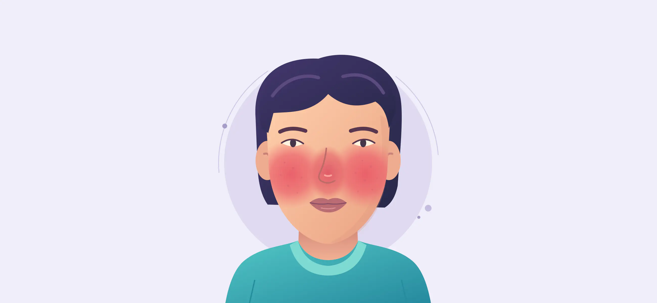 你的脸红是什么红:认识玫瑰痤疮